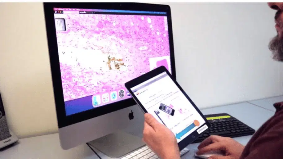 デジタル・パソロジー